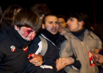 <p>Um jovem foi ferido por  uma carga da polícia em Madrid</p>