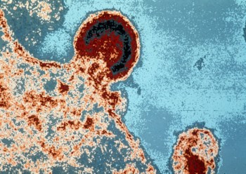 O vírus HIV a sair de um linfócito
