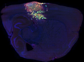 Cérebro de ratinho com um glioma (a verde)