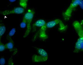 A verde, a proteína CFTR nas membranas de células humanas