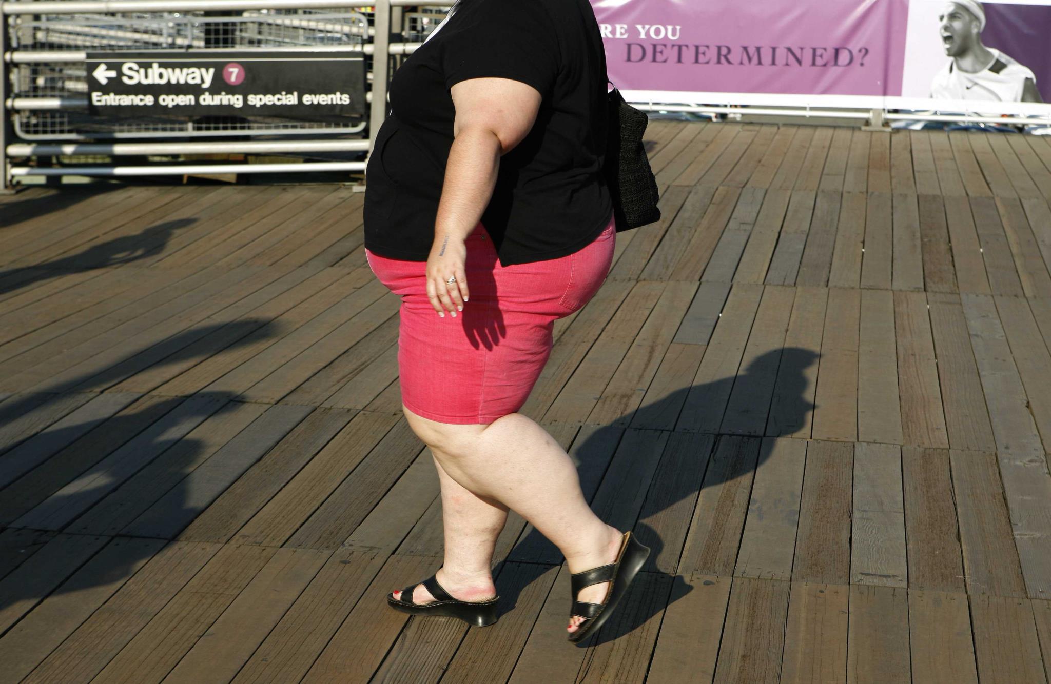 Ноги у толстых людей. Люди с толстыми ногами. Женщины с толстыми ногами. Ожирение 2 степени у женщин.