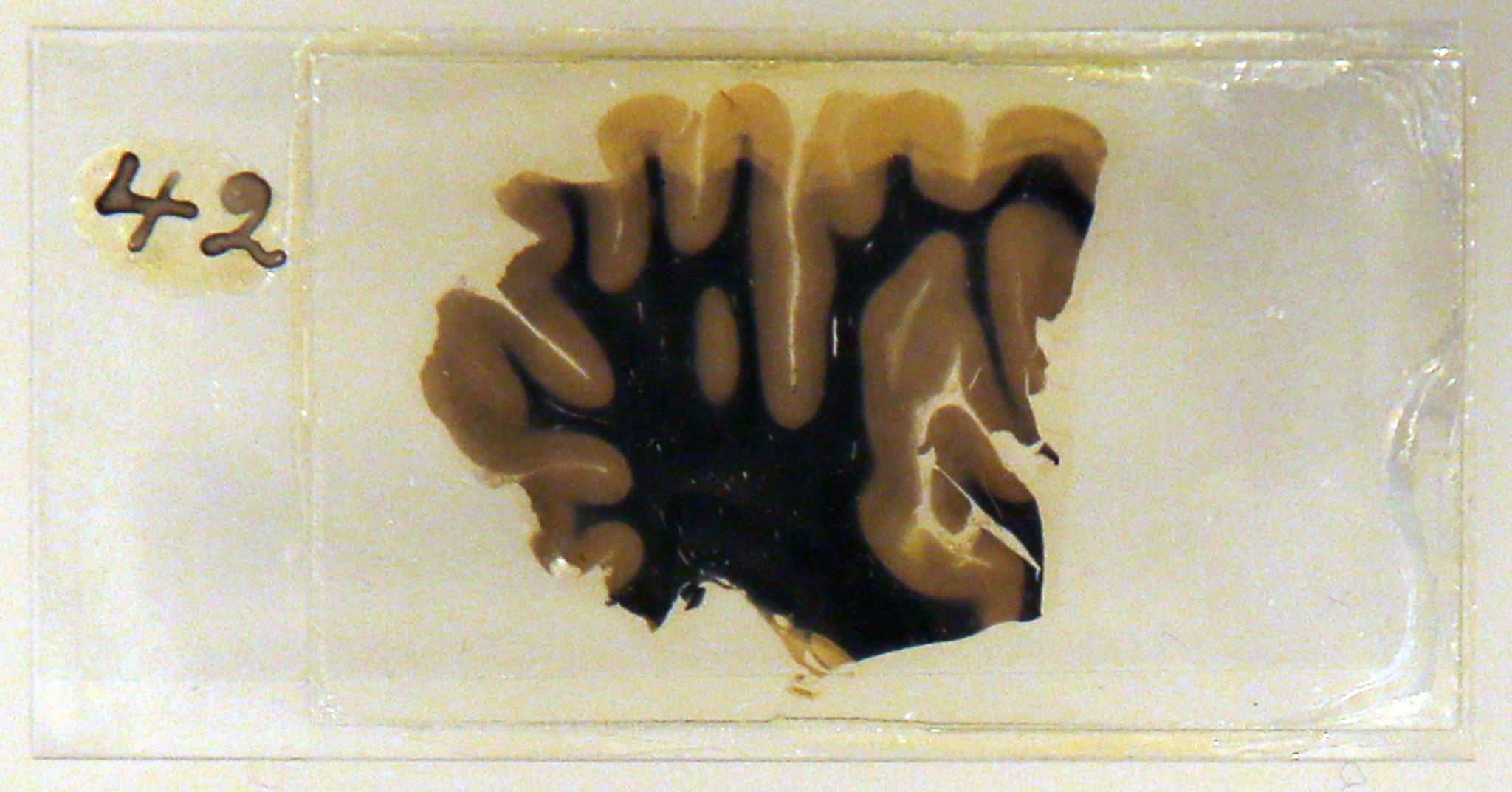 Fragmentos do cérebro de Albert Einstein vão ser expostos na Alemanha |  Museus | PÚBLICO