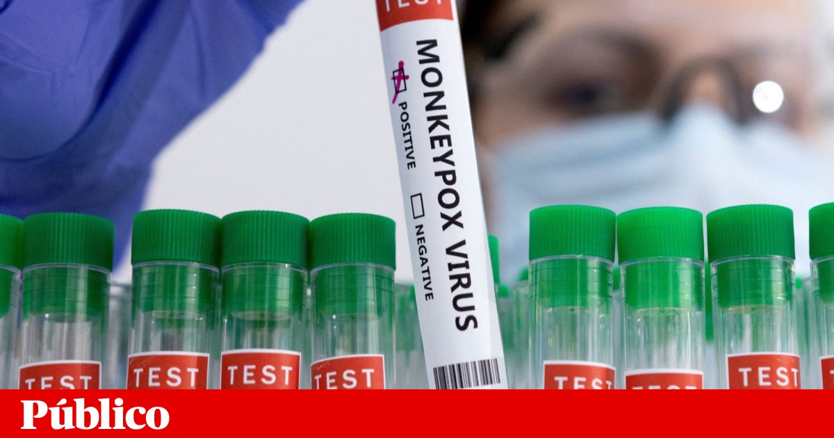 Monkeypox: WHO meldet 780 Fälle in 27 nicht-endemischen Ländern, darunter Portugal |  die Gesundheit