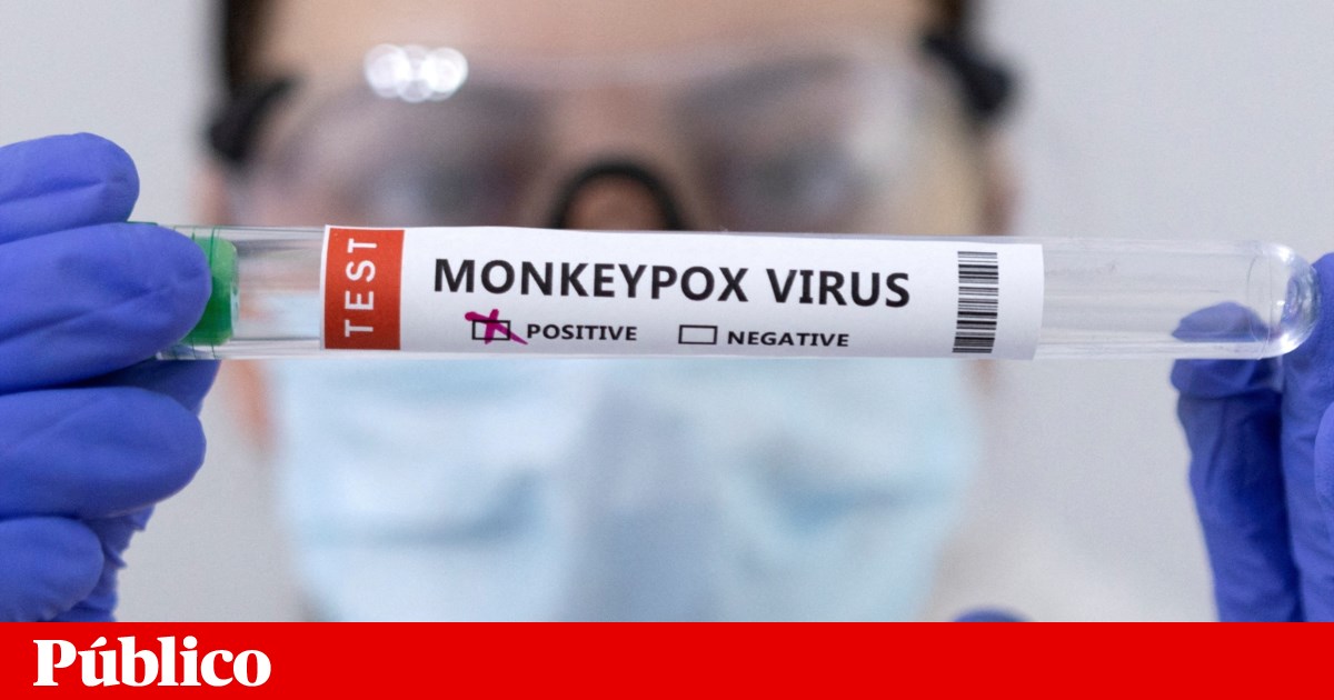 Portuguese tourist first case of monkeypox in the Azores |  monkeypox