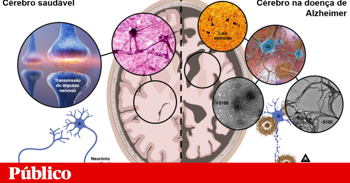 Proteins that prevent scrap formation in Alzheimer’s disease  Tell us about your knowledge Proteins that prevent scrap formation in Alzheimer’s disease  Tell us about your knowledge