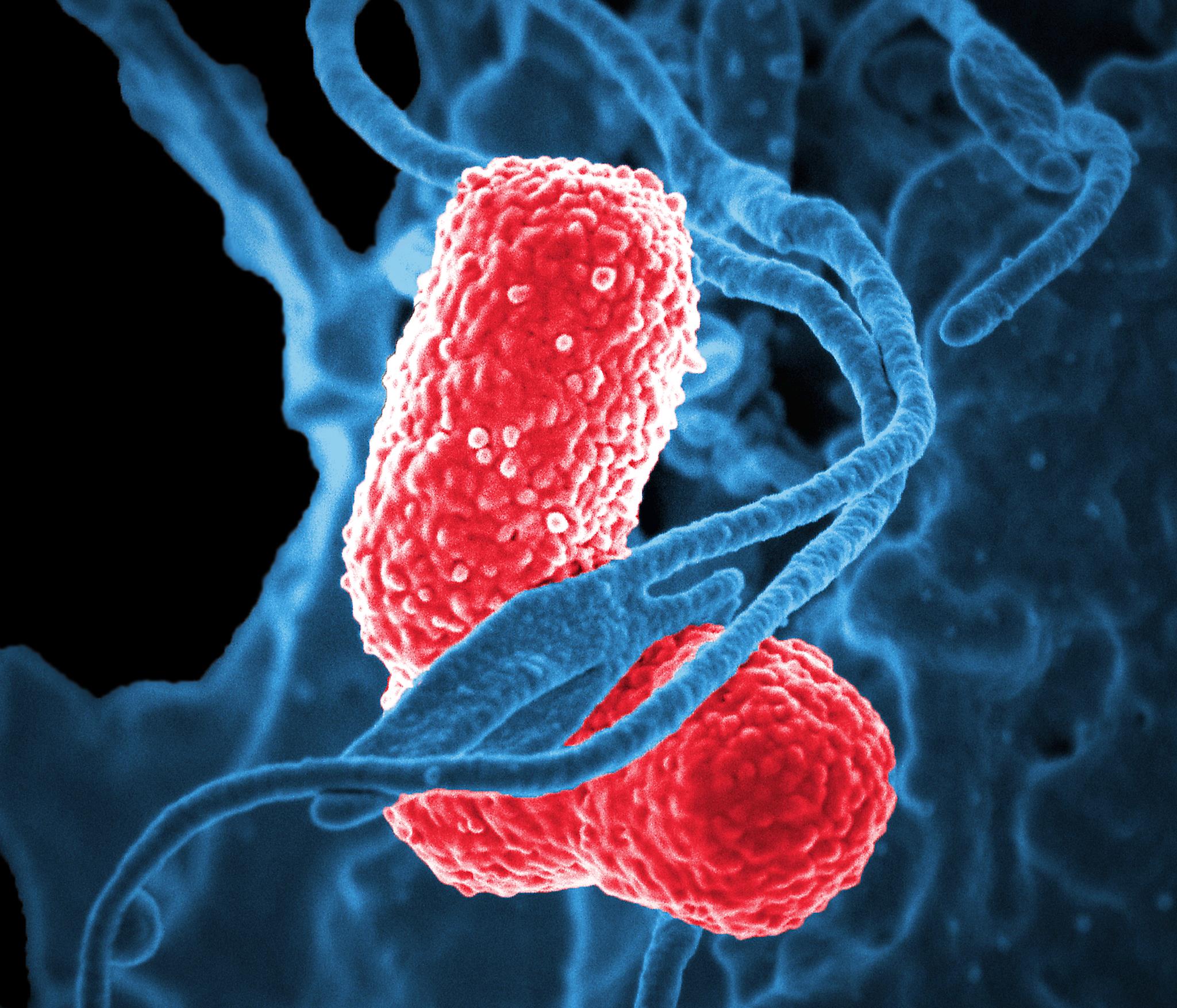 Ein europäisches Zentrum warnt vor der Ausbreitung multiresistenter Bakterien in Europa  Gesundheit