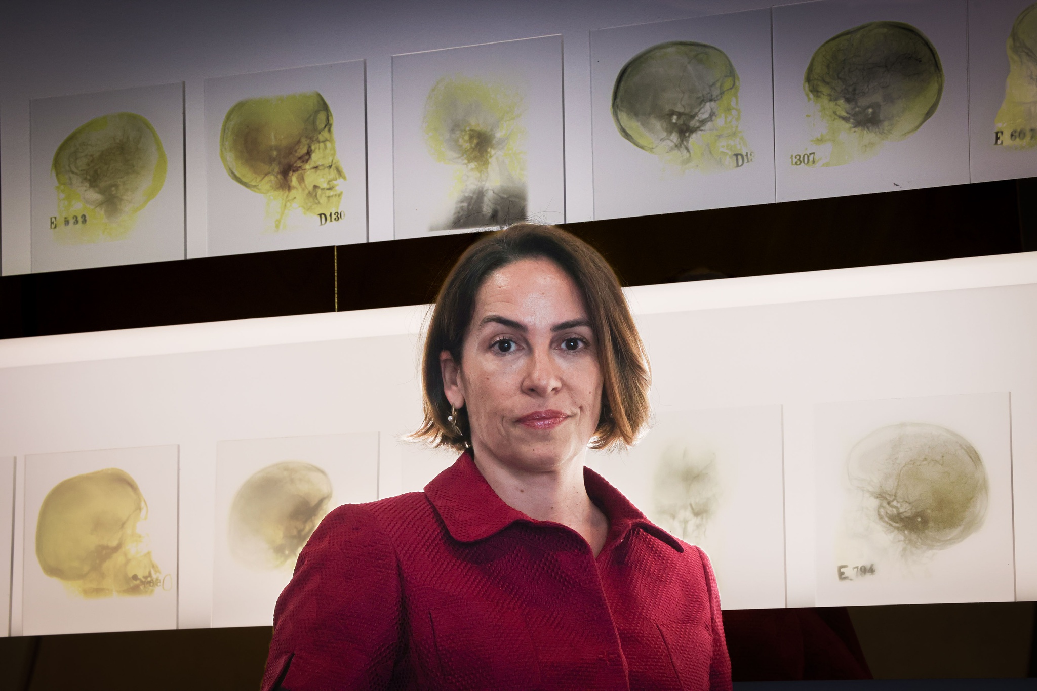 Daniel Rocha 23 de julho 2025 - PORTUGAL, Lisboa Luisa V. Lopes, neurocientista no Instituto de Medicina Molecular de Lisboa Gulbenkian Institute for Molecular Medicine, investigadora na area da neurobiologia