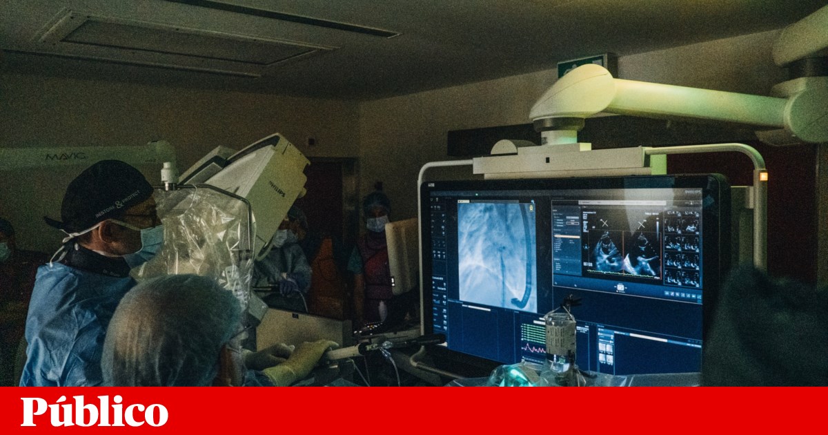 ERS evaluates access to heart surgery. Doctors request reinforcement of existing centres