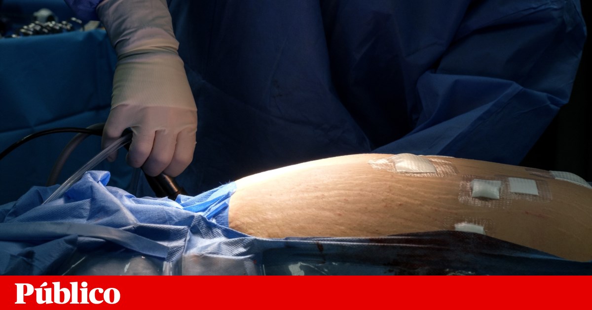 From drug co-payment to tax incentives for healthy habits: measures to prevent and treat obesity