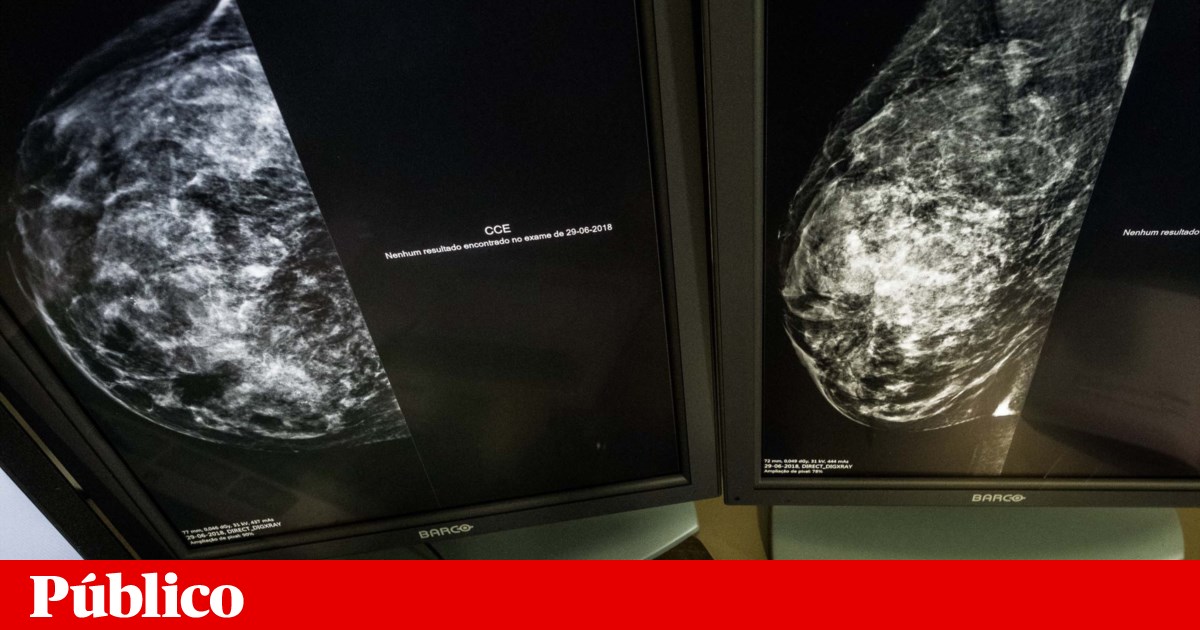 Menopause creates an environment in the breast favourable to the development of cancer cells