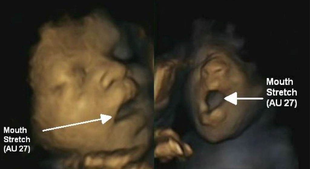 Ainda Na Barriga Da Mae Os Bebes Ja Bocejam Reproducao Humana Publico